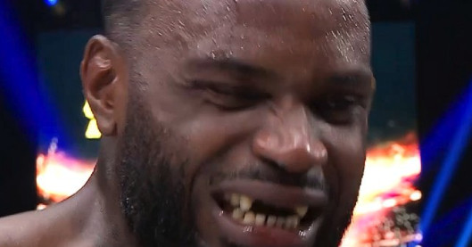 Video: Kickboxer Ulric Bokeme has front teeth brutally knocked out at GLORY Collision 5